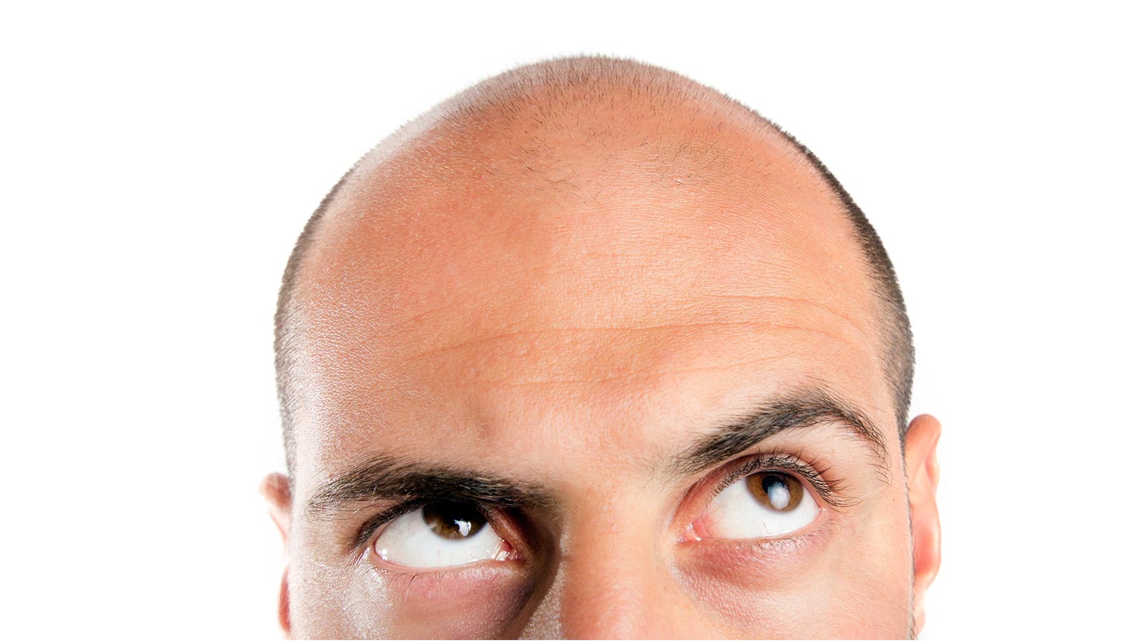 producto milagro calvicie